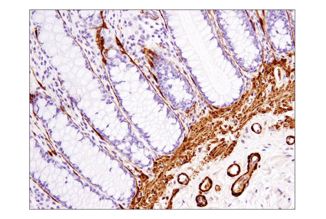 Immunohistochemistry Image 4: α-Smooth Muscle Actin (1A4) Mouse mAb (BSA and Azide Free)