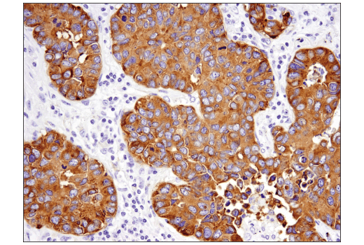 Immunohistochemistry Image 4: Synaptophysin (D8F6H) XP<sup>®</sup> Rabbit mAb (BSA and Azide Free)