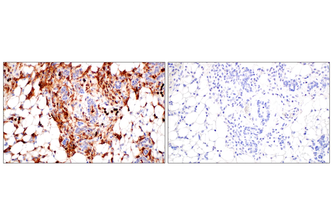 Immunohistochemistry Image 11: CD11b/ITGAM (E4K8C) Rabbit mAb