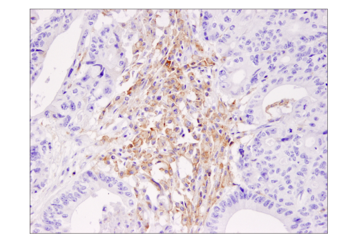 Immunohistochemistry Image 2: TIM-3 (D5D5R<sup>™</sup>) XP<sup>®</sup> Rabbit mAb (BSA and Azide Free)