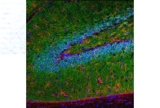 Immunofluorescence Image 1: CaMKII-α (6G9) Mouse mAb