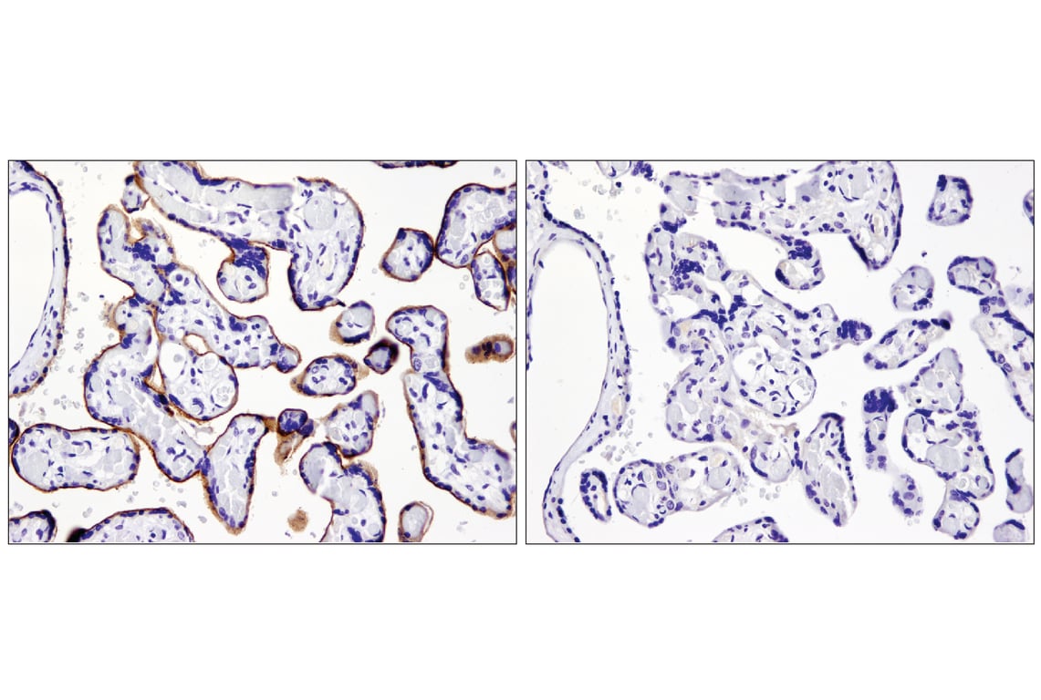 Immunohistochemistry Image 2: PD-L1 (E1L3N<sup>®</sup>) XP<sup>®</sup> Rabbit mAb