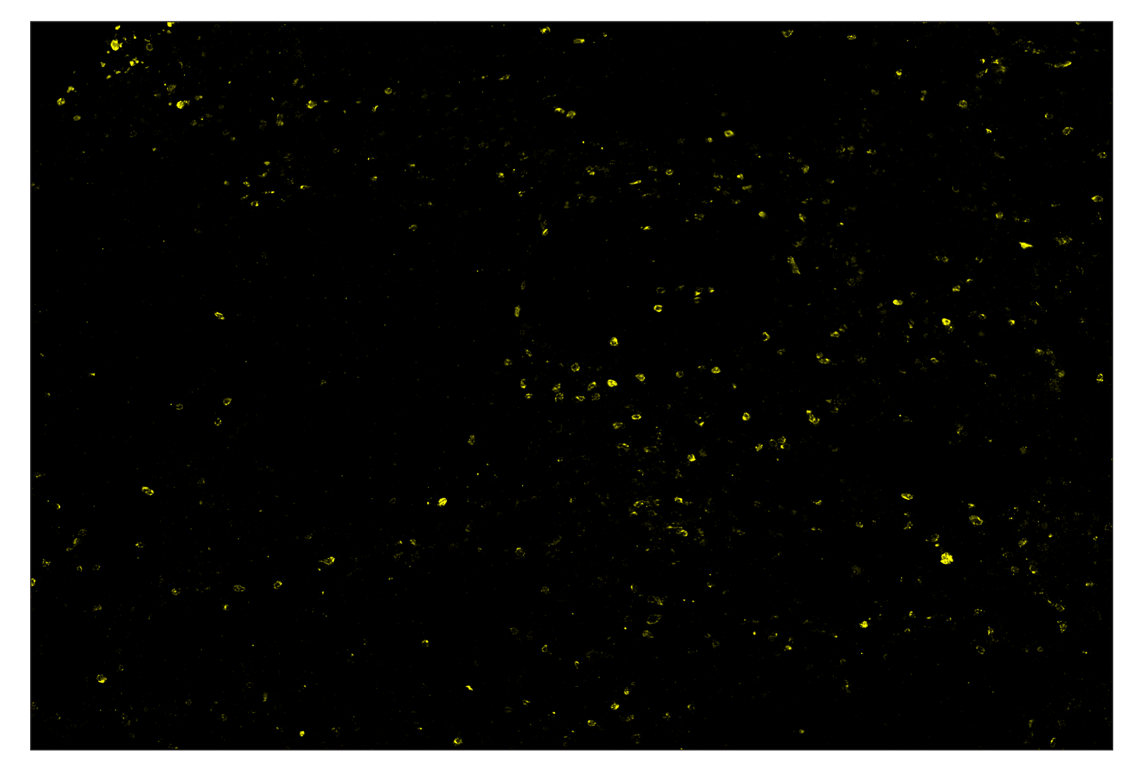 Immunohistochemistry Image 3: CTLA-4 (E2V1Z) & CO-0078-488 SignalStar<sup>™</sup> Oligo-Antibody Pair