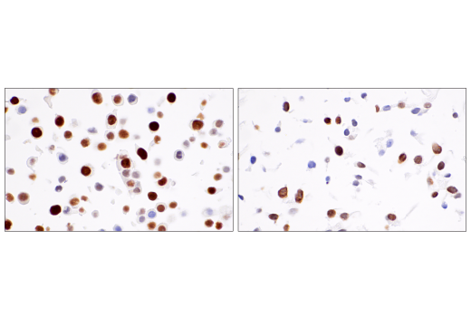 Immunohistochemistry Image 9: ATAD2 (E8Y7F) Rabbit mAb