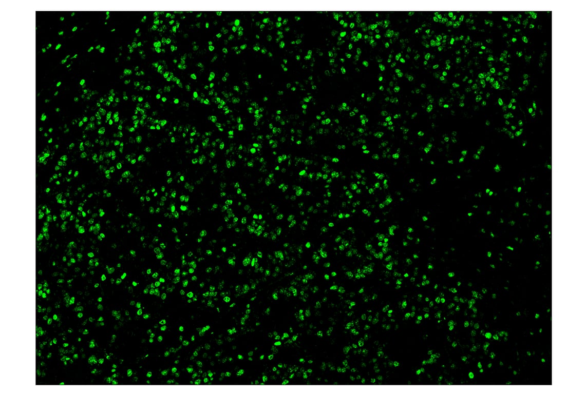 Immunohistochemistry Image 2: Ki-67 (8D5) & CO-0014-647 SignalStar<sup>™</sup> Oligo-Antibody Pair