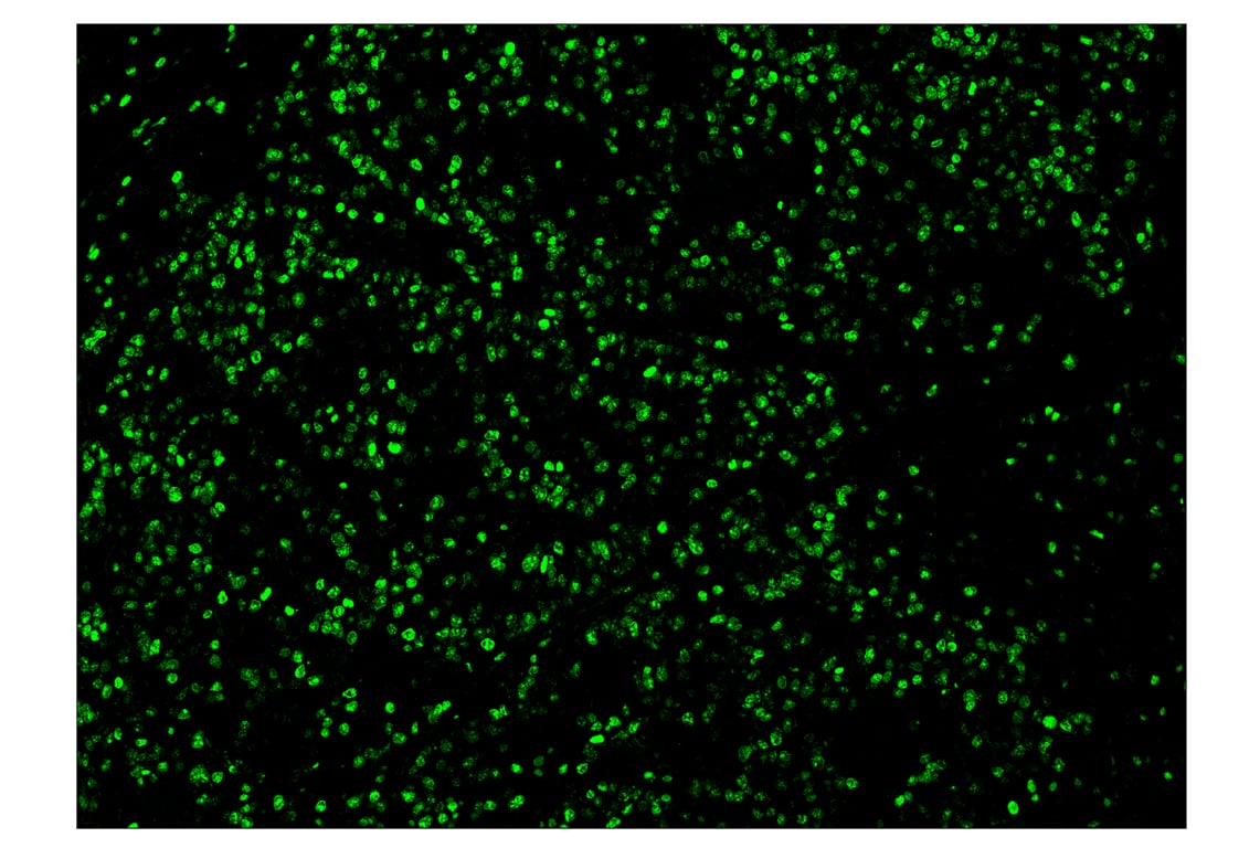 Immunohistochemistry Image 2: Ki-67 (8D5) & CO-0014-647 SignalStar<sup>™</sup> Oligo-Antibody Pair