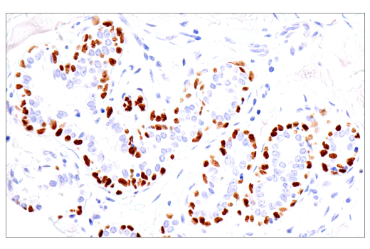 Immunohistochemistry Image 2: p40 (BC28) Mouse mAb