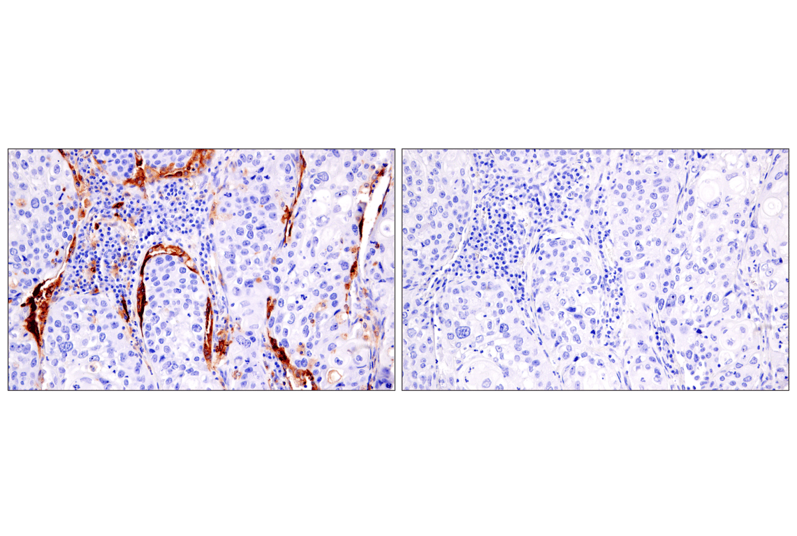 Immunohistochemistry Image 7: HLA-DRA (E9R2Q) XP<sup>®</sup> Rabbit mAb
