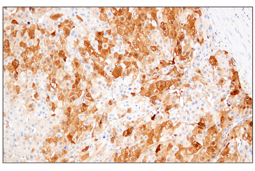 Immunohistochemistry Image 1: Arginase-1 (E4U1I) Mouse mAb (BSA and Azide Free)