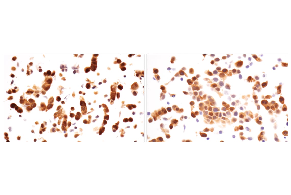 Immunohistochemistry Image 13: ACBP/DBI (E6K8G) XP<sup>®</sup> Rabbit mAb