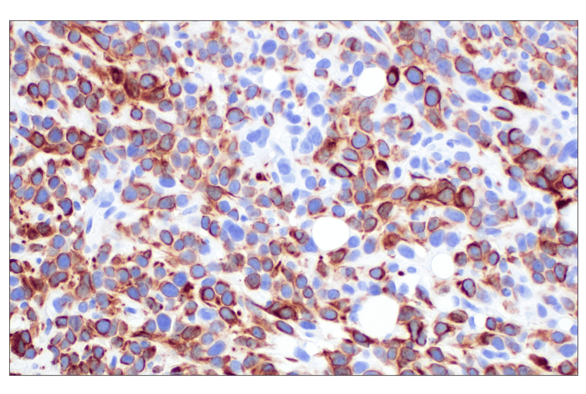 Immunohistochemistry Image 6: Keratin 14 (E7W6V) Rabbit mAb