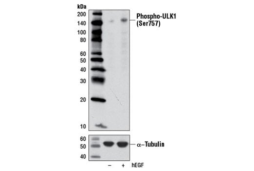 undefined Image 13: ULK1 Antibody Sampler Kit
