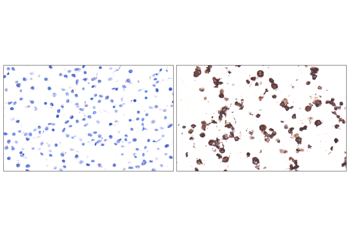 Immunohistochemistry Image 17: Syndecan 1 (E7F7T) Rabbit mAb