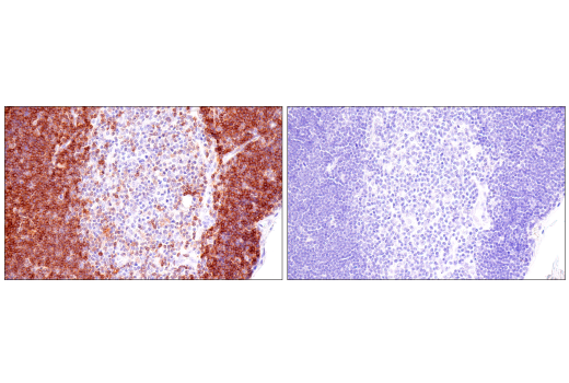 Immunohistochemistry Image 4: CD1A (MTB1) Mouse mAb