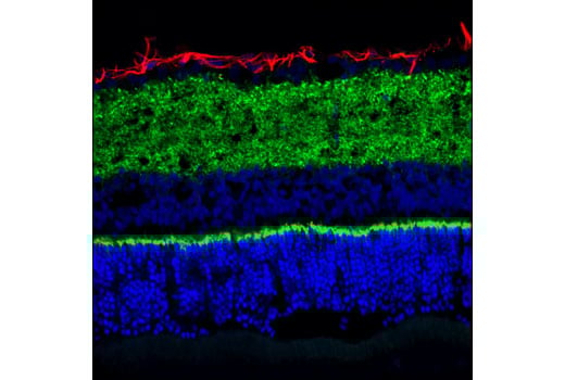 Immunofluorescence Image 1: VAMP2 (D6O1A) Rabbit mAb