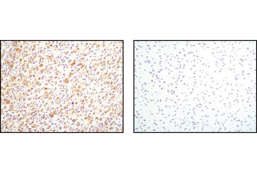 Immunohistochemistry Image 3: PDGF Receptor α (D1E1E) XP<sup>®</sup> Rabbit mAb (BSA and Azide Free)