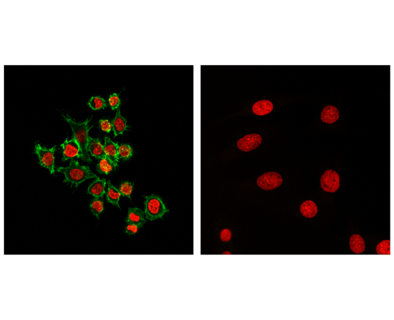 Immunofluorescence Image 1: CD45 (D3F8Q) Rabbit mAb (BSA and Azide Free)