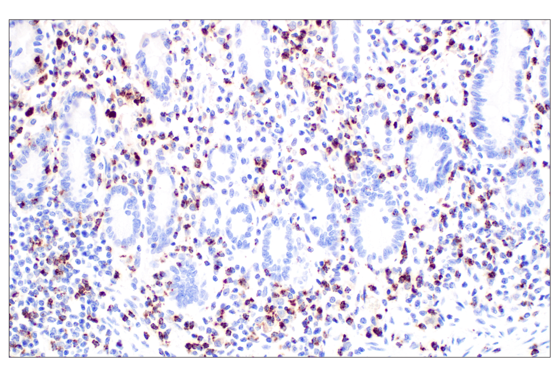 Immunohistochemistry Image 7: NKG7 (F4V5I) Rabbit mAb (BSA and Azide Free)