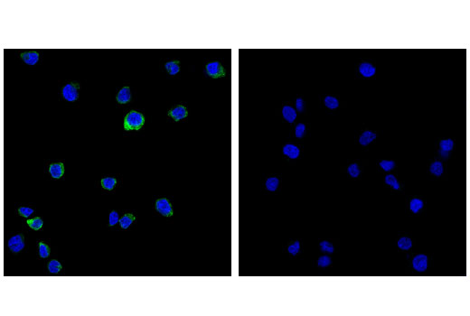 Immunofluorescence Image 1: Toll-like Receptor 9 (D9M9H) XP<sup>®</sup> Rabbit mAb