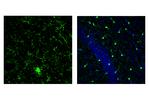 Immunofluorescence Image 1: Iba1/AIF-1 (E4O4W) XP<sup>®</sup> Rabbit mAb (BSA and Azide Free)