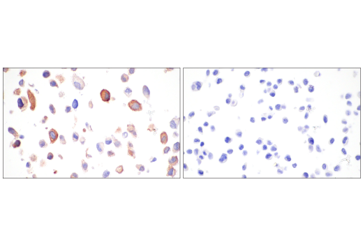 Immunohistochemistry Image 9: LRRK2 (E8Z7T) Mouse mAb