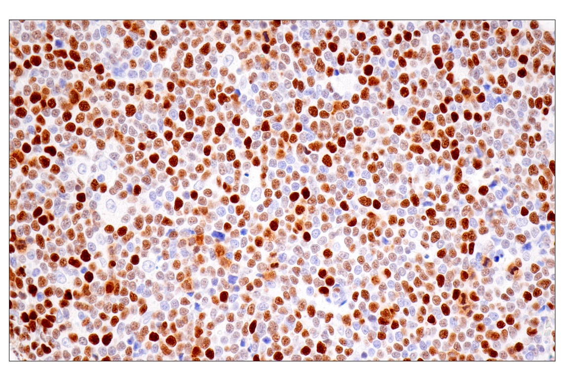 Immunohistochemistry Image 6: UHRF1 (E5W8W) Rabbit mAb