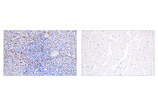 undefined Image 43: Human Reactive PANoptosis Antibody Sampler Kit