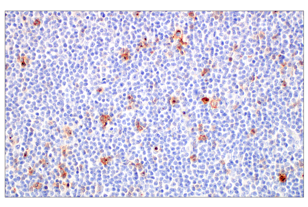 Immunohistochemistry Image 5: CD70 (E3Q1A) Rabbit mAb