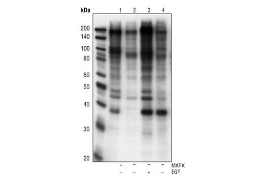 Western Blotting Image 1: Phospho-MAPK Substrates (PXTP) (46G11) Rabbit mAb