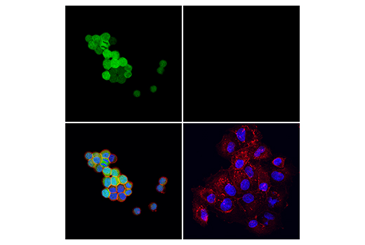 Immunofluorescence Image 1: Calretinin (E7R6O) XP<sup>®</sup> Rabbit mAb