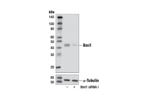 undefined Image 1: SignalSilence<sup>®</sup> Bmi1 siRNA I