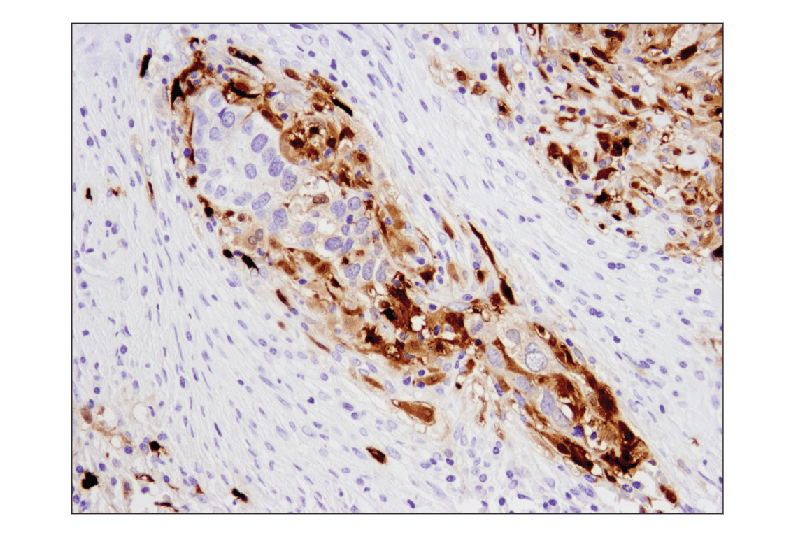Immunohistochemistry Image 4: S100A9 (D5O6O) Rabbit mAb (BSA and Azide Free)