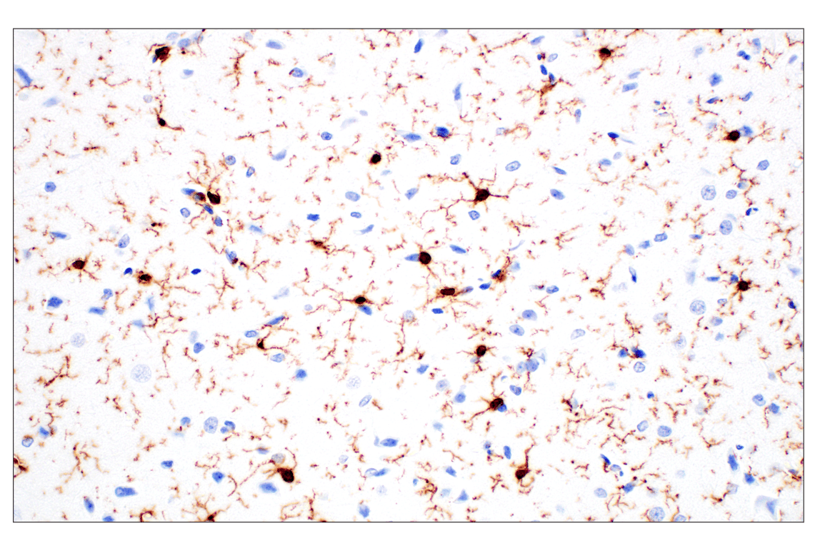 Immunohistochemistry Image 12: Iba1/AIF-1 (E4O4W) XP<sup>®</sup> Rabbit mAb (BSA and Azide Free)