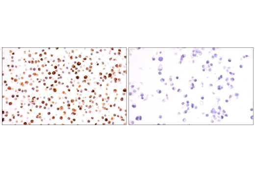 Immunohistochemistry Image 6: Osteopontin/SPP1 (E9Z1D) Rabbit mAb (BSA and Azide Free)