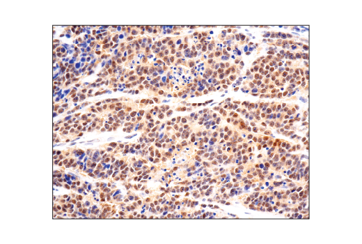 Immunohistochemistry Image 1: SMAD4 (D3R4N) XP<sup>®</sup> Rabbit mAb