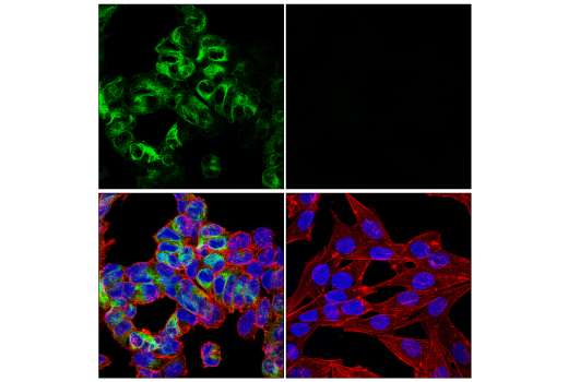 Immunofluorescence Image 1: Neurofilament-H (E7Z7G) Rabbit mAb