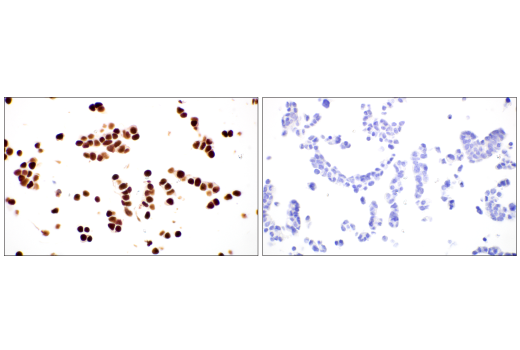 Immunohistochemistry Image 9: POU2F3 (E5N2D) XP<sup>®</sup> Rabbit mAb