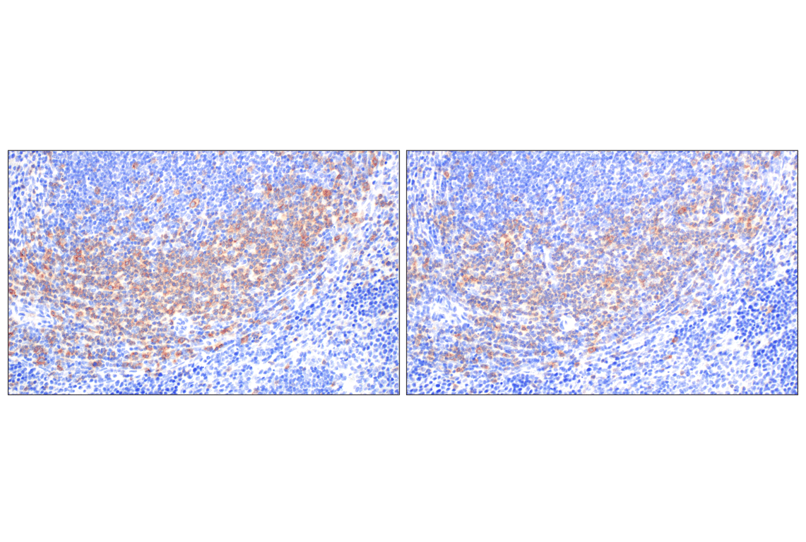 Immunohistochemistry Image 6: CD27 (F3R2V) Rabbit mAb