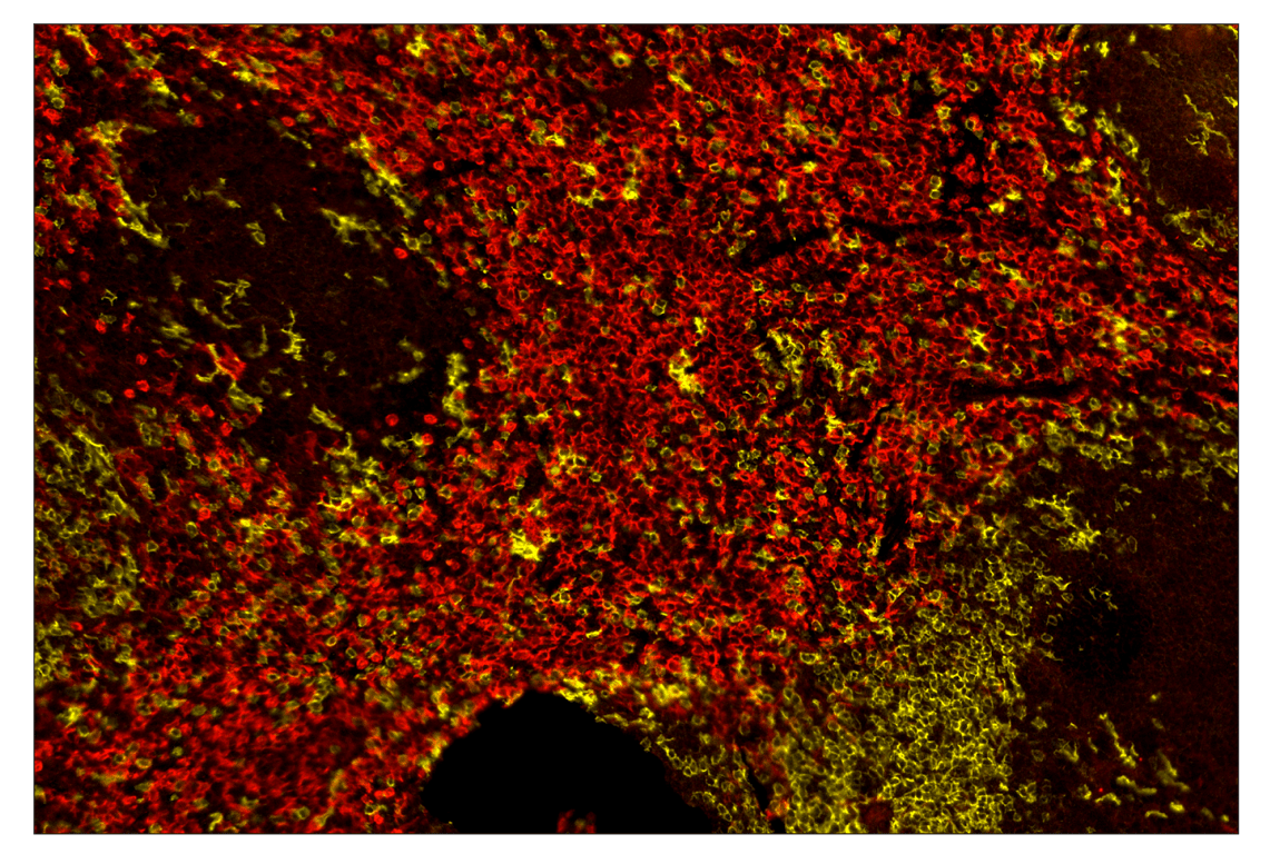 Immunohistochemistry Image 1: CD8α (D4W2Z) & CO-0040-488 SignalStar<sup>™</sup> Oligo-Antibody Pair