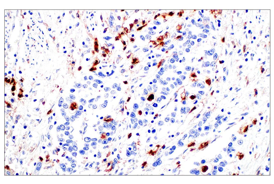 Immunohistochemistry Image 6: CD11b/ITGAM (E3J2F) Rabbit mAb