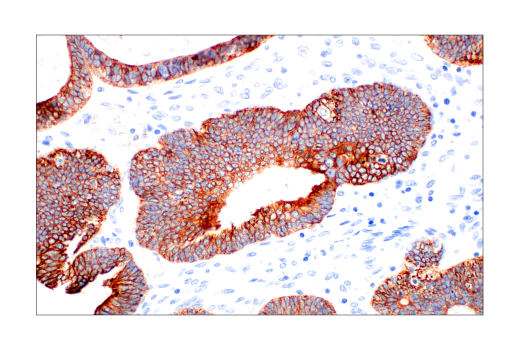 Immunohistochemistry Image 5: Pan-Keratin (AE1/AE3) Mouse mAb
