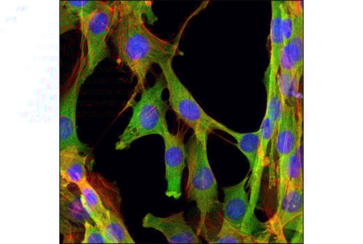 Immunofluorescence Image 1: GAPDH (D16H11) XP<sup>®</sup> Rabbit mAb (BSA and Azide Free)