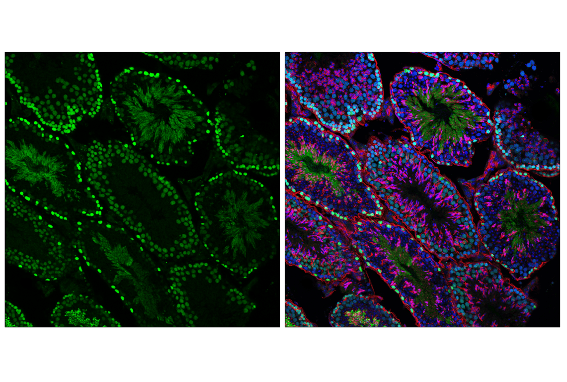 Immunofluorescence Image 2: Phospho-Rb (Ser807/811) (D20B12) XP<sup>®</sup> Rabbit mAb