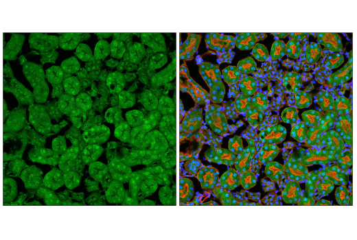 Immunofluorescence Image 2: p70 S6 Kinase (E8K6T) XP<sup>®</sup> Rabbit mAb