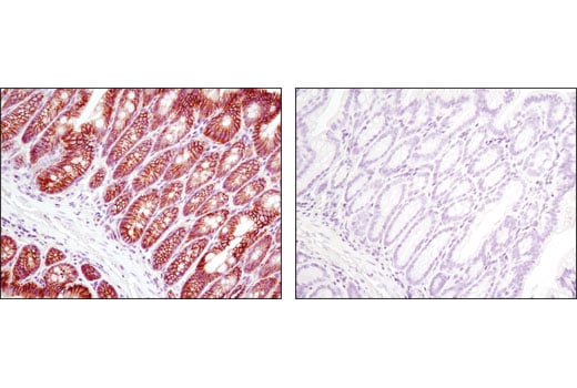 Immunohistochemistry Image 4: Non-phospho (Active) β-Catenin (Ser33/37/Thr41) (D13A1) Rabbit mAb