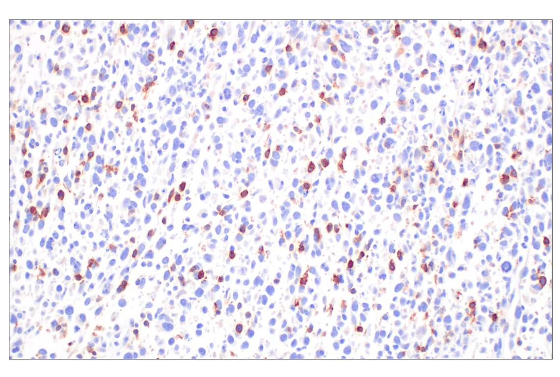 Immunohistochemistry Image 2: CD27 (F3R2V) Rabbit mAb