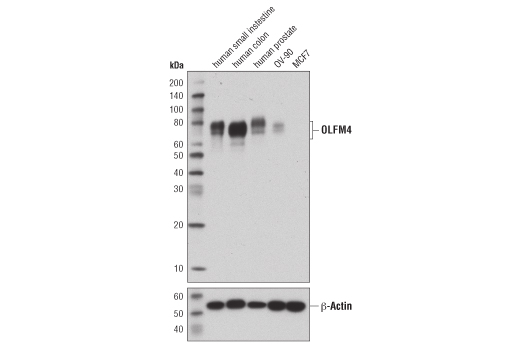 Western Blotting Image 1: OLFM4 (D1E4M) XP<sup>®</sup> Rabbit mAb