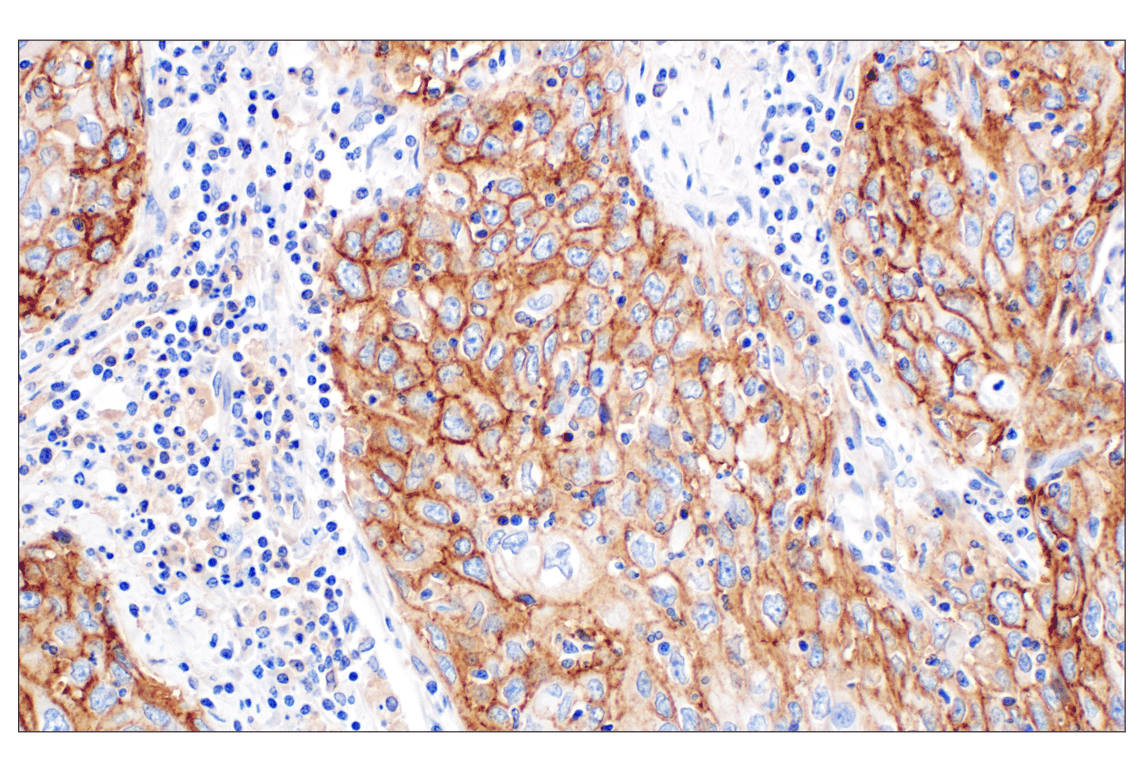 Immunohistochemistry Image 3: CD44 v5 (C44Mab-3) Mouse mAb