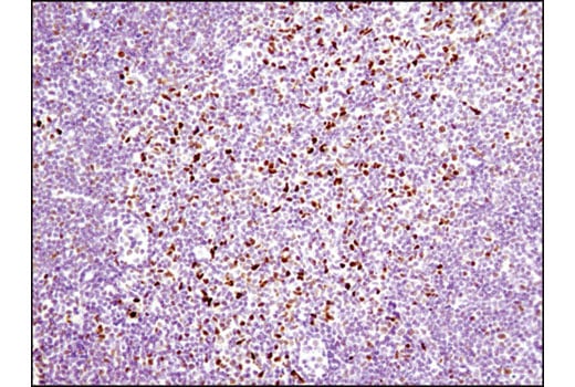 Immunohistochemistry Image 5: RBPSUH (D10A4) XP<sup>®</sup> Rabbit mAb