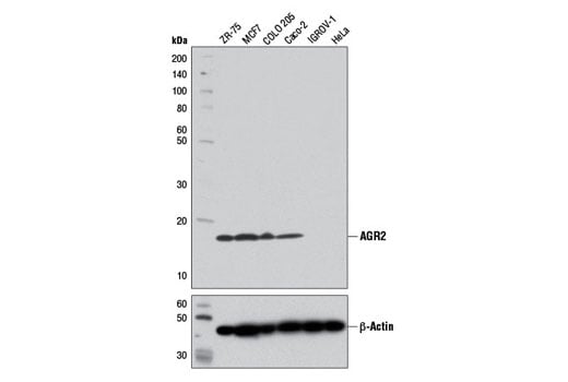 Western Blotting Image 1: AGR2 (D9V2F) XP<sup>®</sup> Rabbit mAb (BSA and Azide Free)